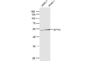 ZFP14 Antikörper  (AA 121-220)