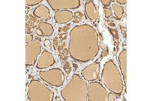 IHC analysis of Citrin/SLC25A13 using anti-Citrin/SLC25A13 antibody (ABIN7599512). (slc25a13 Antikörper  (AA 1-643))
