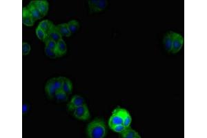Immunofluorescent analysis of MCF-7 cells using ABIN7150145 at dilution of 1:100 and Alexa Fluor 488-congugated AffiniPure Goat Anti-Rabbit IgG(H+L) (DRAM2 Antikörper  (AA 182-266))