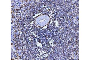 IHC analysis of CD20 using anti-CD20 antibody (ABIN7599180). (CD20 Antikörper  (AA 1-261))