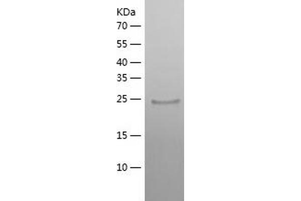 ABHD14B Protein (AA 1-210) (His tag)