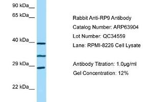 Western Blotting (WB) image for anti-Retinitis Pigmentosa 9 (Autosomal Dominant) (RP9) (C-Term) antibody (ABIN971593) (RP9 Antikörper  (C-Term))