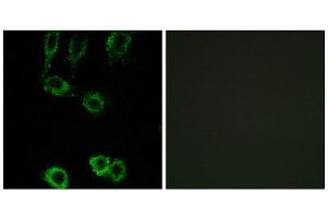 Immunofluorescence (IF) image for anti-Calponin 2 (CNN2) (Internal Region) antibody (ABIN1850970) (CNN2 Antikörper  (Internal Region))