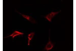 ABIN6278565 staining Hela cells by IF/ICC. (DOK5 Antikörper  (C-Term))