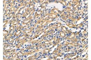 ABIN6263797 and ABIN6278500 at 1/100 staining Mouse kidney tissue by IHC-P. (OCRL Antikörper  (C-Term))