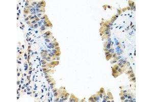 Immunohistochemistry of paraffin-embedded Mouse lung using ARSF Polyclonal Antibody at dilution of 1:100 (40x lens). (ARSF Antikörper)