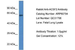Western Blotting (WB) image for anti-Acyl-CoA Synthetase Family Member 2 (ACSF2) (C-Term) antibody (ABIN2788584) (ACSF2 Antikörper  (C-Term))