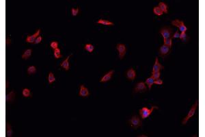 ABIN6266863 staining K-562 cells by IF/ICC. (MORF4L1 Antikörper  (N-Term))