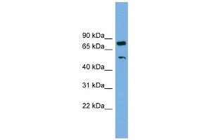 RBM42 antibody used at 1 ug/ml to detect target protein. (RBM42 Antikörper  (Middle Region))