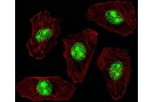 Fluorescent image of A549 cell stained with NPM1 antibody. (NPM1 Antikörper  (AA 7-33))