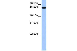 WB Suggested Anti-hCG_1646157 Antibody Titration:  0.