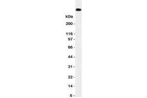 Western blot testing of DNA PKcs antibody and HeLa cell lysate. (PRKDC Antikörper  (N-Term))