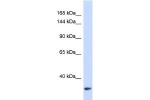 Western Blotting (WB) image for anti-MDM2 Binding Protein (MTBP) (Middle Region) antibody (ABIN2446252) (MTBP Antikörper  (Middle Region))