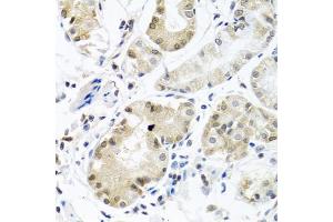 Immunohistochemistry of paraffin-embedded human stomach using PCBP1 antibody. (PCBP1 Antikörper)