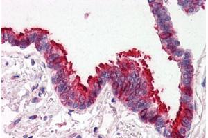 Human Lung, Respiratory Epithelium (formalin-fixed, paraffin-embedded) stained with SKIL antibody ABIN214478 at 2. (SKIL Antikörper  (N-Term))