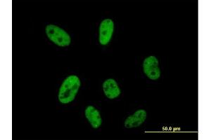 Immunofluorescence of purified MaxPab antibody to CPSF2 on HeLa cell. (CPSF2 Antikörper  (AA 1-782))