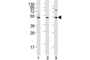 Western blot testing of LAG3 antibody at 1:2000 dilution tested on human lysates, Lane 1: K562; 2: liver; 3: ovary; Predicted molecular weight ~54 kDa. (LAG3 Antikörper  (AA 103-132))