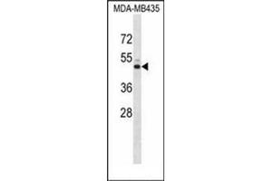 Western blot analysis of KCNJ13 Antibody (N-term) in MDA-MB435 cell line lysates (35ug/lane). (KCNJ13 Antikörper  (N-Term))