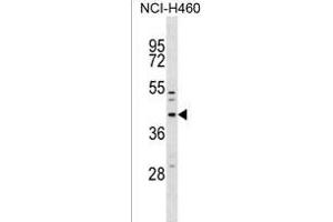 MFF Antibody (Center) (ABIN1537829 and ABIN2838250) western blot analysis in NCI- cell line lysates (35 μg/lane). (MFF Antikörper  (AA 133-162))