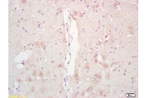 Formalin-fixed and paraffin embedded rat brain labeled with Rabbit Anti Phospho-Acetyl CoA Carboxylase(Ser79) /ACACA Polyclonal Antibody, Unconjugated (ABIN1386220) at 1:200 followed by conjugation to the secondary antibody and DAB staining (Acetyl-CoA Carboxylase Antikörper  (pSer79))