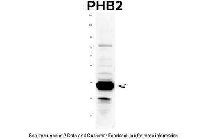 WB Suggested Anti-PHB2 Antibody Titration: 1 ug/mlPositive Control: Rat tissue (Prohibitin 2 Antikörper  (C-Term))