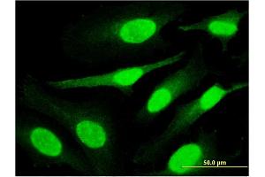 Immunofluorescence of monoclonal antibody to PPHLN1 on HeLa cell. (PPHLN1 Antikörper  (AA 168-258))