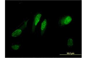 Immunofluorescence of monoclonal antibody to C13orf15 on HeLa cell. (RGC32 Antikörper  (AA 1-117))