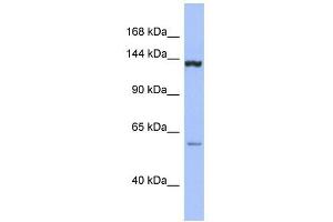 DHX34 antibody used at 1 ug/ml to detect target protein. (DHX34 Antikörper)