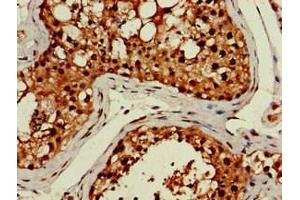 Immunohistochemistry of paraffin-embedded human testis tissue using ABIN7158320 at dilution of 1:100