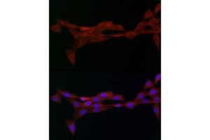 Immunofluorescence analysis of NIH/3T3 cells using Alph-adaptin/ Rabbit pAb (ABIN6130980, ABIN6136955, ABIN6136957 and ABIN6221039) at dilution of 1:50 (40x lens). (AP2A2 Antikörper  (AA 590-939))