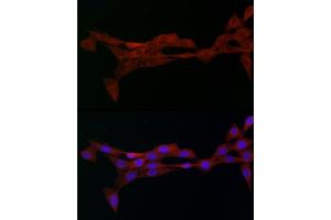 Immunofluorescence (IF) image for anti-Adaptor-Related Protein Complex 2, alpha 2 Subunit (AP2A2) (AA 590-939) antibody (ABIN6136955)
