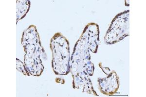 IHC analysis of GHITM using anti-GHITM antibody (ABIN7599294). (GHITM Antikörper  (AA 1-345))