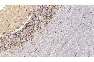 Immunohistochemistry (IHC) image for anti-Voltage-Dependent Anion Channel 1 (VDAC1) (AA 2-283) antibody (ABIN7427192)
