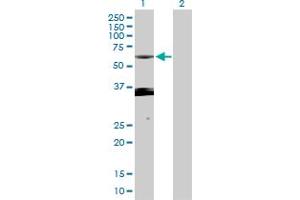 Western Blot analysis of PXK expression in transfected 293T cell line by PXK MaxPab polyclonal antibody.