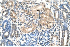 Immunohistochemistry (IHC) image for anti-Ubiquitin-Conjugating Enzyme E2E 2 (UBE2E2) (N-Term) antibody (ABIN2781267)