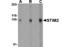 Western Blotting (WB) image for anti-Stromal Interaction Molecule 2 (Stim2) (Middle Region) antibody (ABIN1031110)