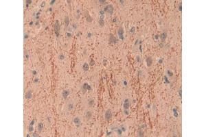 Immunohistochemistry (IHC) image for anti-Inositol Polyphosphate-4-Phosphatase, Type I, 107kDa (INPP4A) (AA 1-137) antibody (ABIN1868712)