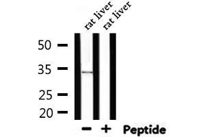 Western blot analysis of extracts from rat liver, using MyD88 Antibody.