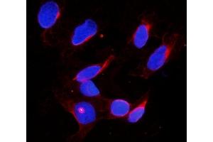 IF analysis of DDX4 using anti-DDX4 antibody (ABIN7601203).