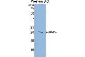 Western blot analysis of the recombinant protein. (MYL9 Antikörper  (AA 5-163))
