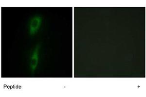 Immunofluorescence analysis of HeLa cells, using ACVRL1 polyclonal antibody . (ACVRL1 Antikörper)