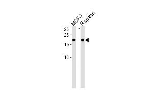 CNBP Antibody (Center) (ABIN1881216 and ABIN2839107) western blot analysis in MCF-7 cell line and rat spleen tissue lysates (35 μg/lane). (CNBP Antikörper  (AA 91-118))