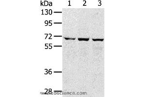 Western blot analysis of 293T, hepg2 and A172 cell, using SLC5A9 Polyclonal Antibody at dilution of 1:300 (SLC5A9 Antikörper)