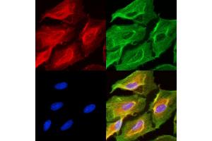 ABIN6256988 and ABIN6275146 staining  cells(UV treatment) by IF/ICC. (GJC2 Antikörper  (N-Term))