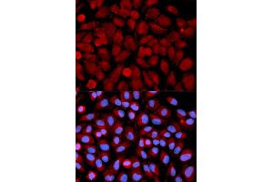 Immunofluorescence analysis of U2OS cells using MAPK9 antibody. (JNK2 Antikörper)