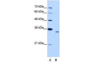 WB Suggested Anti-RBM4B  Antibody Titration: 2. (RBM4B Antikörper  (C-Term))