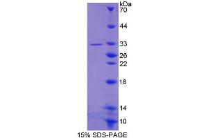 Image no. 1 for ATP-Binding Cassette, Sub-Family A (ABC1), Member 5 (ABCA5) (AA 1401-1642) protein (T7 tag,His tag) (ABIN4989922) (ABCA5 Protein (AA 1401-1642) (T7 tag,His tag))