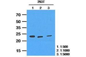 Western Blotting (WB) image for anti-Hypoxanthine phosphoribosyltransferase 1 (HPRT1) antibody (ABIN781535) (HPRT1 Antikörper)