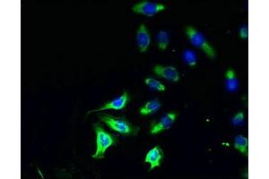 Immunofluorescent analysis of A549 cells using ABIN7163341 at dilution of 1:100 and Alexa Fluor 488-congugated AffiniPure Goat Anti-Rabbit IgG(H+L)