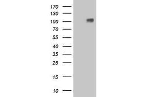 Western Blotting (WB) image for anti-Leucine-Rich Repeat Containing G Protein-Coupled Receptor 4 (LGR4) (AA 230-540) antibody (ABIN1491239) (LGR4 Antikörper  (AA 230-540))